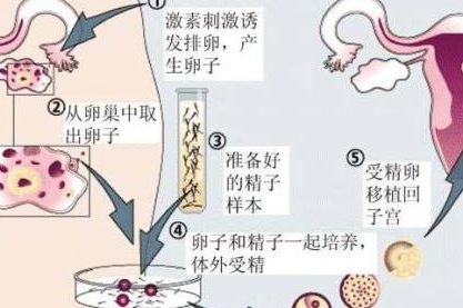 详细解读诸城市做长方案试管婴儿费用，长方案和短方案成功率有差别吗？