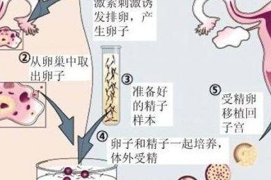 汾阳做超高龄三代试管如何提升成功率？把握这五点成功率翻一番