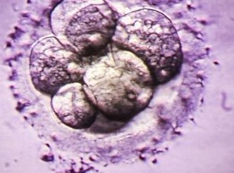 青岛私立医院做试管婴儿治疗全程价格明细曝光